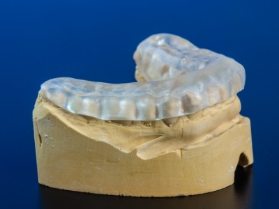 Occlusal splint for T M J treatment resting on model of lower arch of teeth